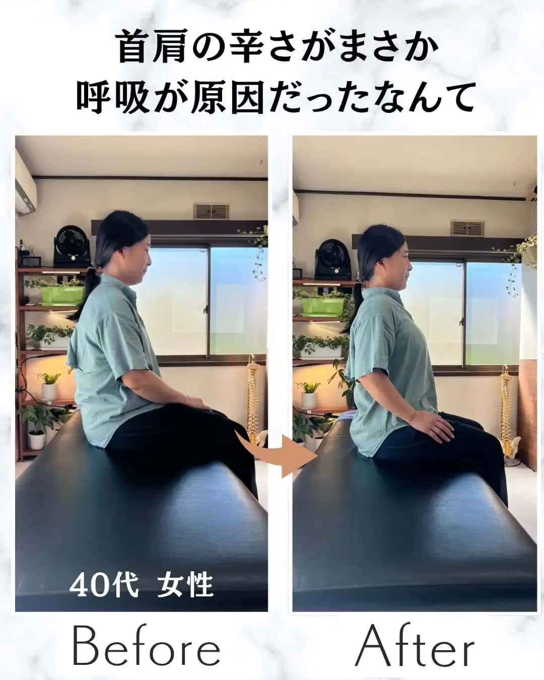 頭痛がなかなか改善しない…。その原因は「姿勢」にあるかもしれません