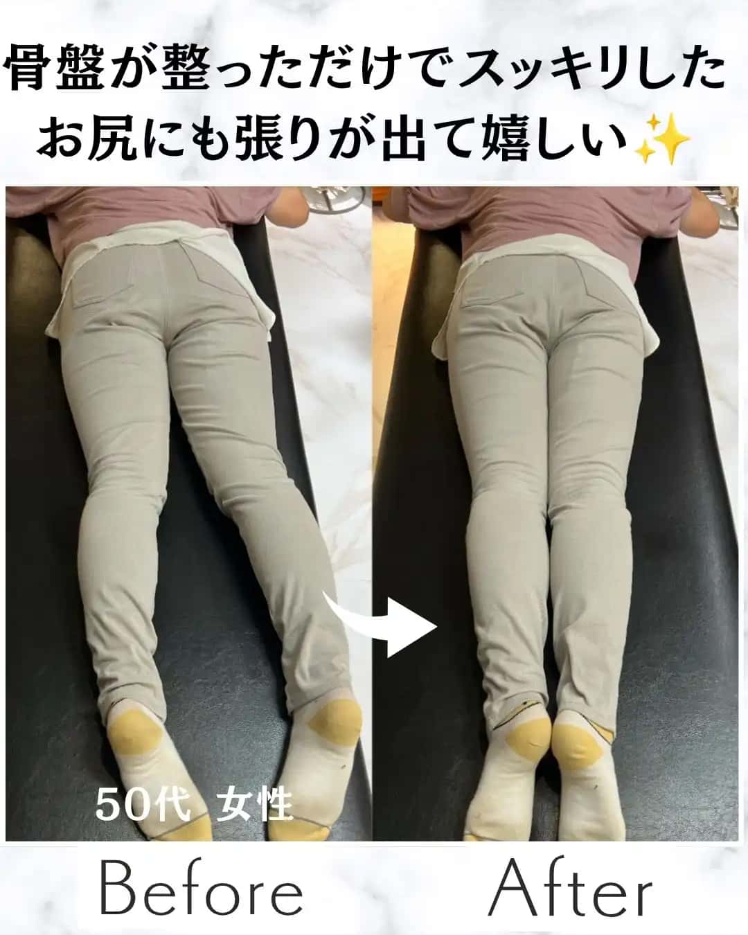 股関節の痛み、将来への不安
