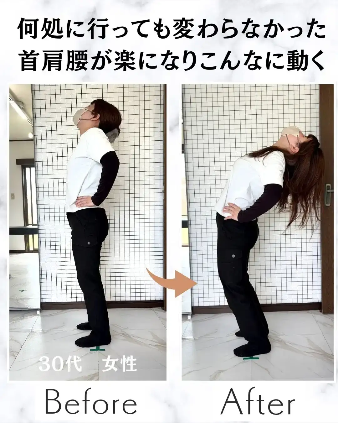 腕のしびれ、本当の原因は別の場所に