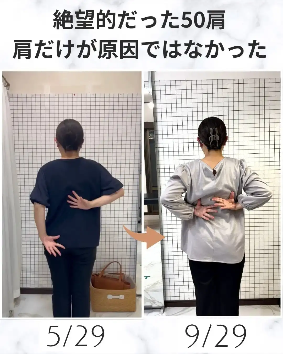 腕が上がらない朝との決別